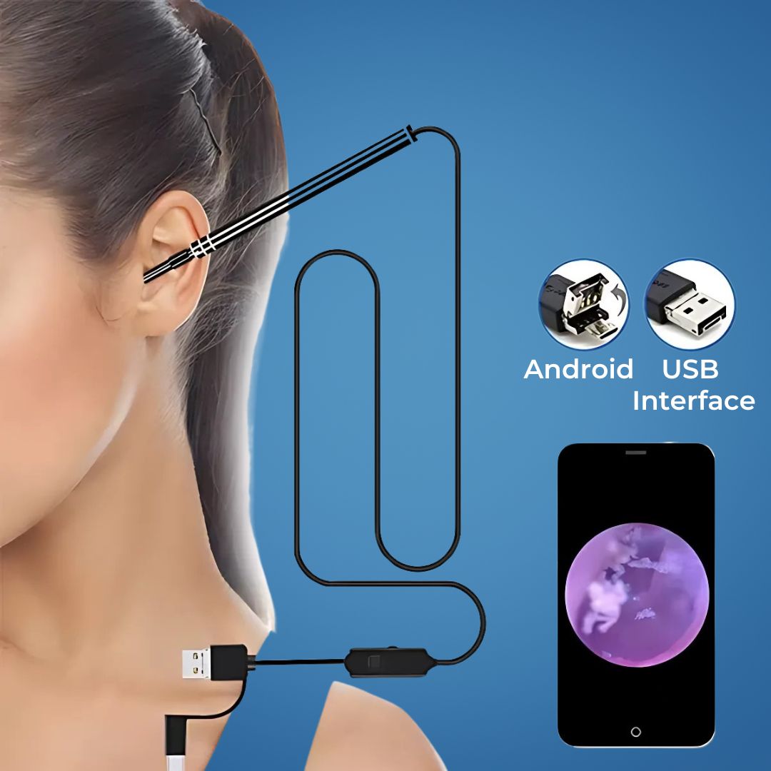 Digital ear endoscope with HD camera for safe earwax removal & detailed ear canal inspection.
