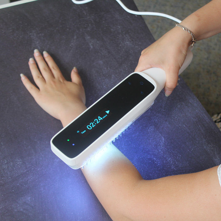 Handheld UVB phototherapy lamp for home psoriasis and vitiligo treatment, offering targeted light therapy.