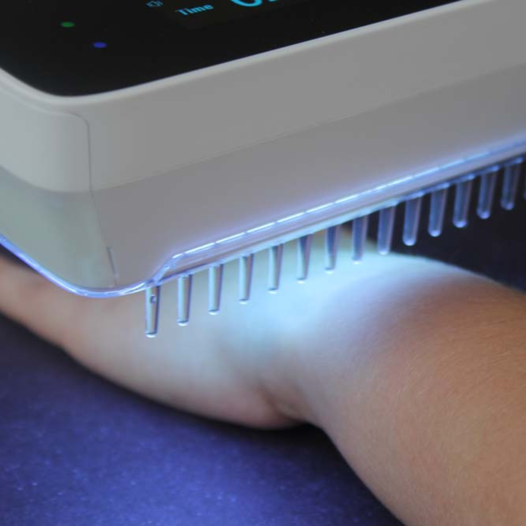 Portable UVB light therapy device, ideal for treating psoriasis, vitiligo, and eczema at home.