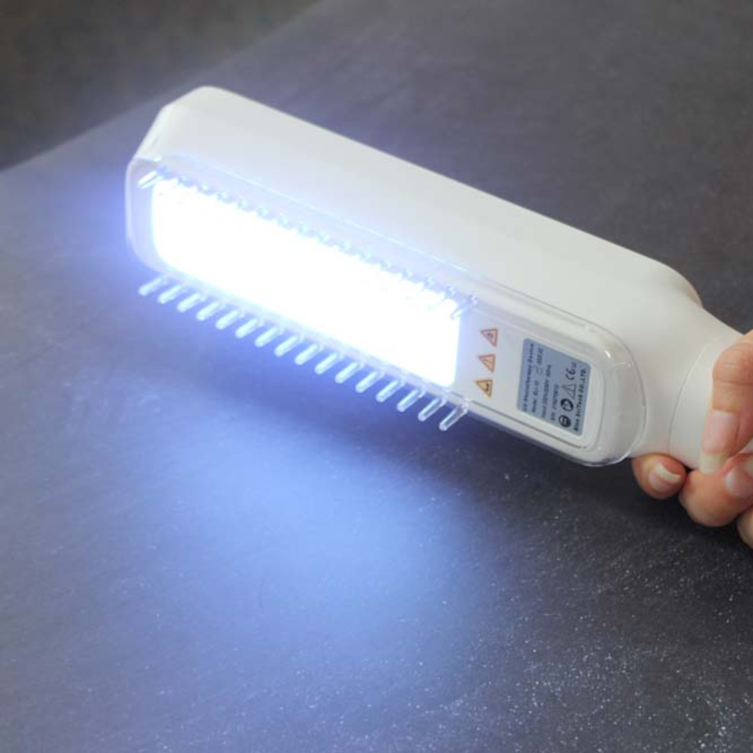 Home-use handheld UVB phototherapy lamp for safe and effective psoriasis, vitiligo, and eczema relief.