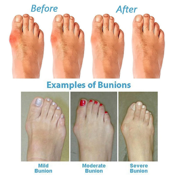 Supportive women's comfort sandals with orthopaedic design for ergonomic foot health & all-day wear in spring.