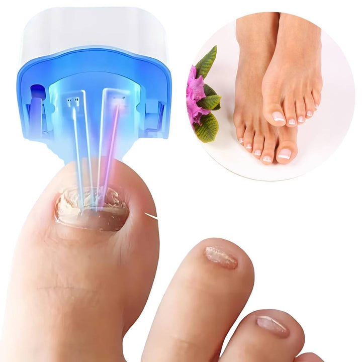 Rechargeable nail fungus laser treatment device for quick, at-home care of toenail & fingernail fungus. Get clear, healthy nails.