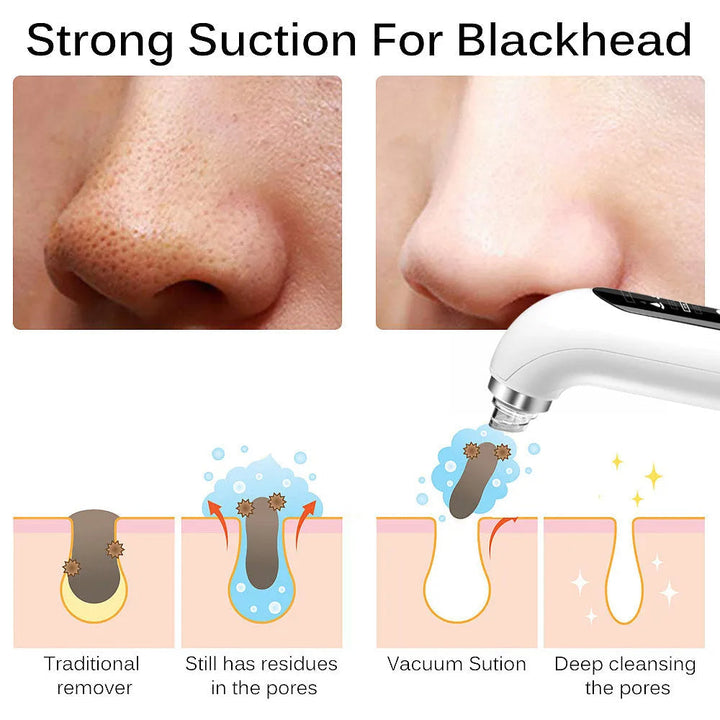 Sleek unisex electric blackhead vacuum. Compact skincare device for deep pore cleansing & clear, radiant face care.