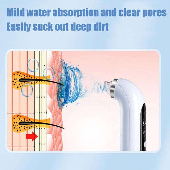 Electric blackhead remover & pore cleaner. Essential skincare device for deep skin cleansing & effective acne treatment.
