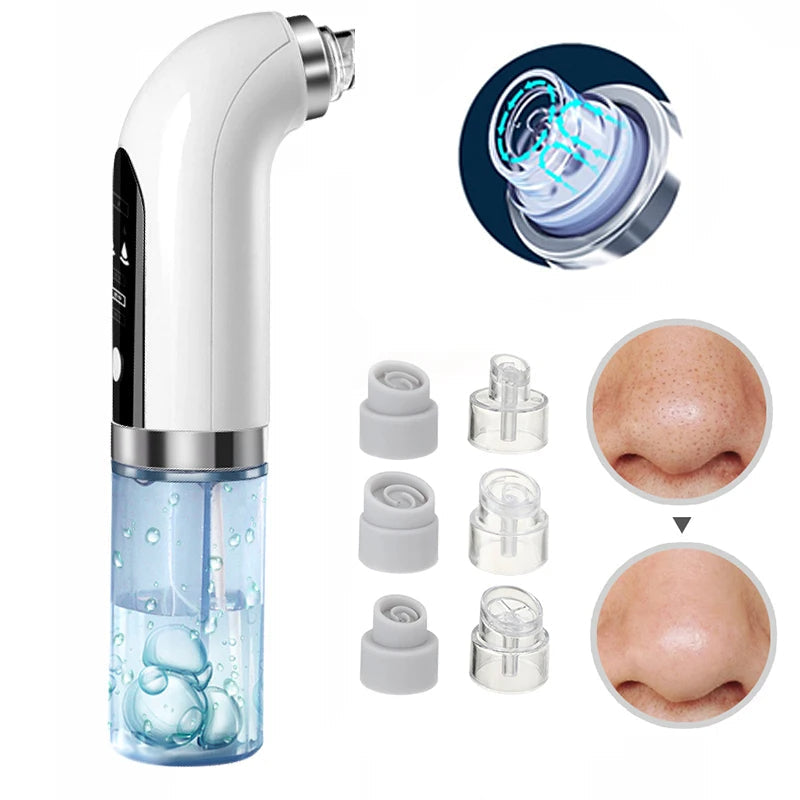 Unisex face care tool: electric blackhead vacuum for clear skin. Deep pore cleansing & acne treatment beauty device.