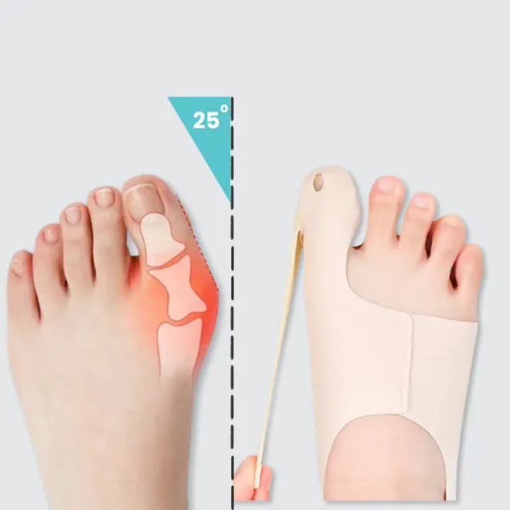 Comfortable stretch fabric Hallux Corrector Sleeve for daily bunion support & big toe alignment. Unisex foot care solution.